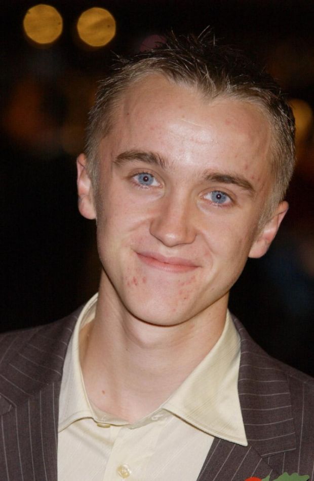 Tom Felton