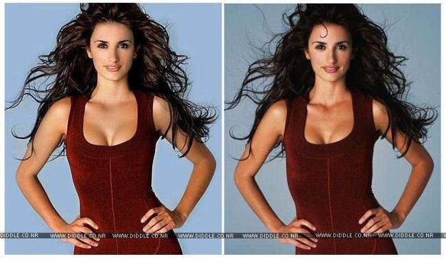 Celebrities Botox Before and After
