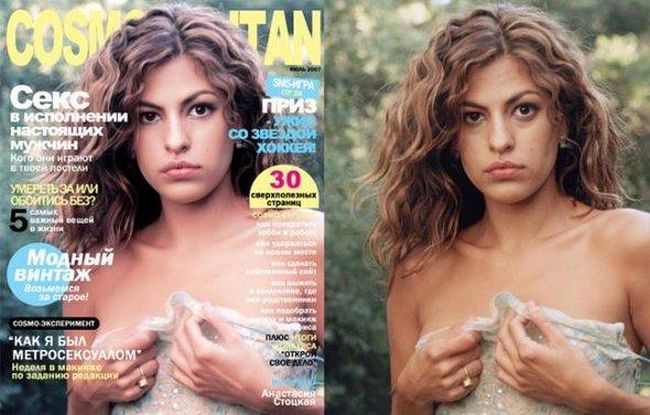 Celebrities Botox Before and After