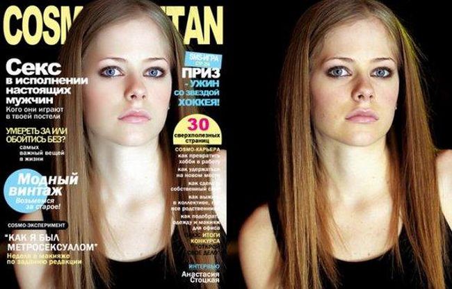 Celebrities Botox Before and After
