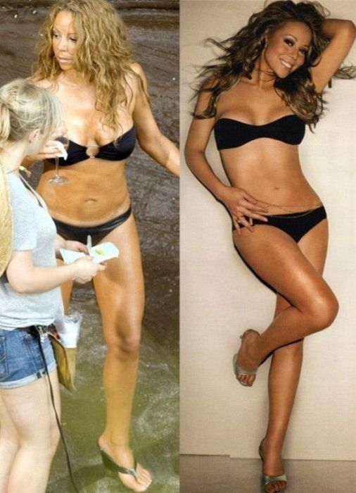 Celebrities Botox Before and After