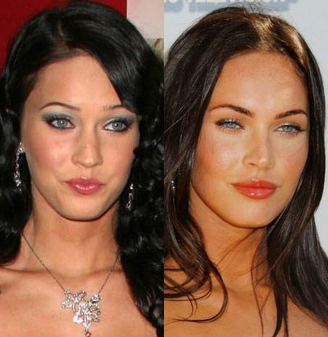 Celebrities Botox Before and After
